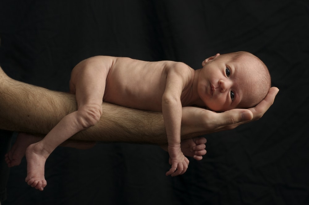 AI Unlocks Secrets Behind Preterm Births in India