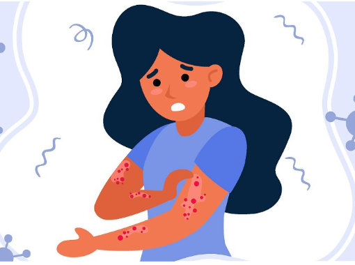Bengaluru Faces Skin Issues Amid Dry Weather
