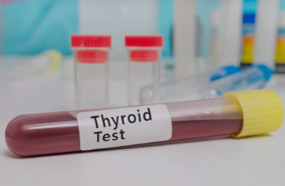 Delhi NCR 33% of Thyroid Tests Show Abnormal Results