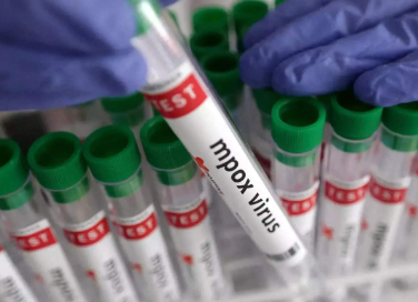 21-Day Quarantine Imposed for Suspected Mpox