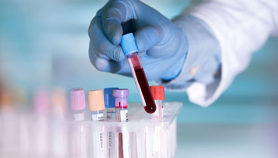 BMC's Aapli Chikitsa Diagnostics Halted, Temporary SOP Issued