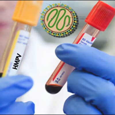 Two-Month-Old Tests Positive for HMPV in Ahmedabad Case Rises to 3