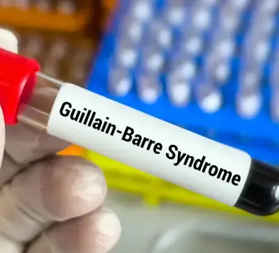 Guillain-Barré Syndrome Death Toll in Pune Rises to Six; Caseload Hits 173