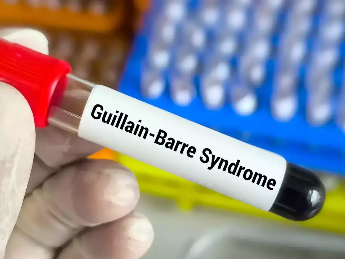 Mumbai Reports Guillain-Barré Syndrome in Woman